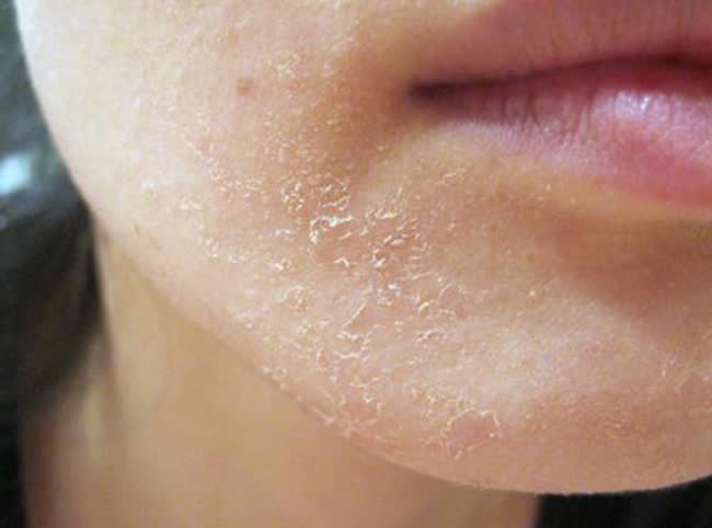 Cách sửa lớp nền bị cakey bằng mút ẩm